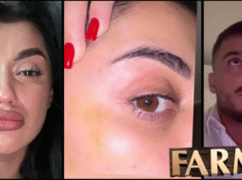 VIDEO: Týral ma, bil, šikanoval, šokuje Azra, ukazuje foto s modrinami. Takto jej ex Pavol ihneď reaguje