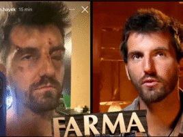 VIDEO: Riša z Farmy zmlátili. Má rozbitú tvár, monokel a modriny. Máte, čo ste chceli, odkazuje divákom