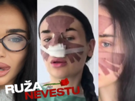 VIDEO: Merci prvýkrát ukázala, ako vyzerala pred úpravami: ,,Veď bola krásna, prirodzená, žasnú diváci